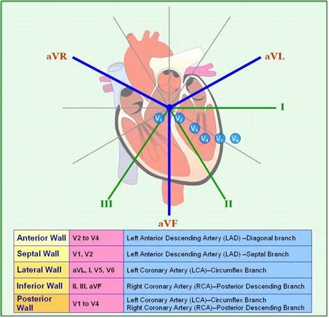 Little Baby Nurse — ccrnhustle: 12 Lead EKG Changes in MI by...