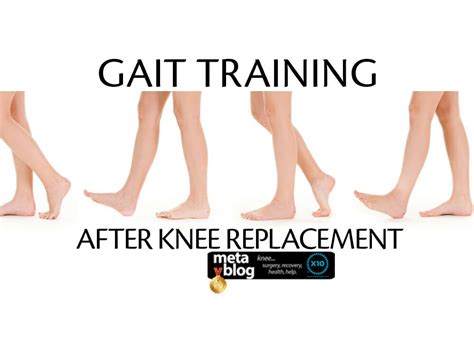 Gait Training After Knee Replacement | X10 Therapy