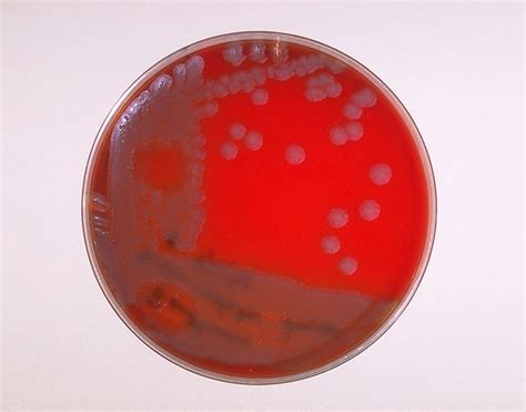 Public Domain Picture | Blood agar plate culture of Bacillus anthracis ...