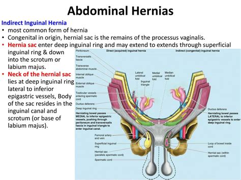 PPT - Posterior Abdominal Wall PowerPoint Presentation, free download - ID:4864651