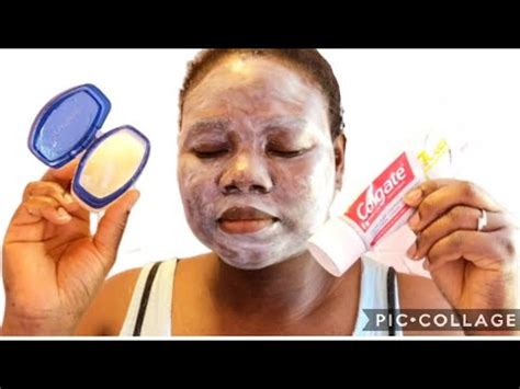 TOOTHPASTE AND VASELINE MASK IN FACE | WORKS LIKE MAGIC - YouTube