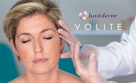 Juvéderm Volite - Good Skin Days