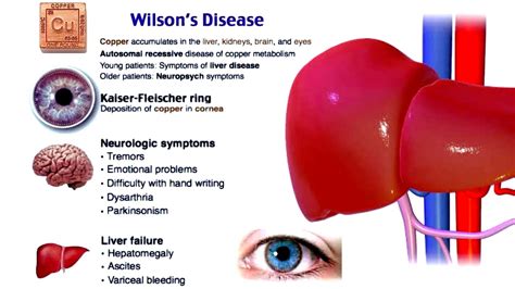 Wilsons Disease Skin