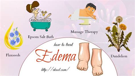 10 Ways On How To Treat Edema Naturally In Hands And Legs