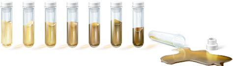 What is gas condensate