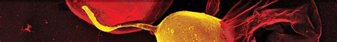 Malaria Parasite Density Estimated with White Blood Cells Count Reference Value Agrees with ...