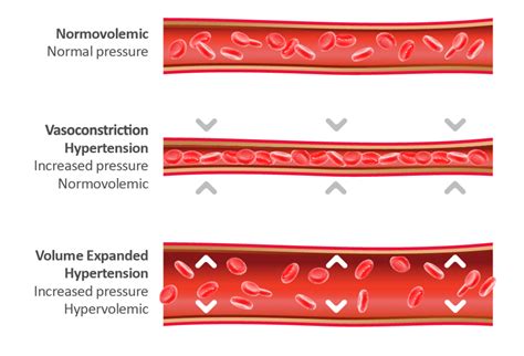 Why is Blood Volume Analysis Important? | Daxor