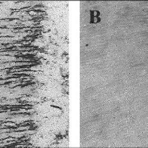 (PDF) Invasion of Dentinal Tubules by Oral Bacteria