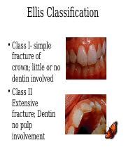 Classification of Traumatic Injuries.ppt - Ellis Classification • Class I- simple fracture of ...