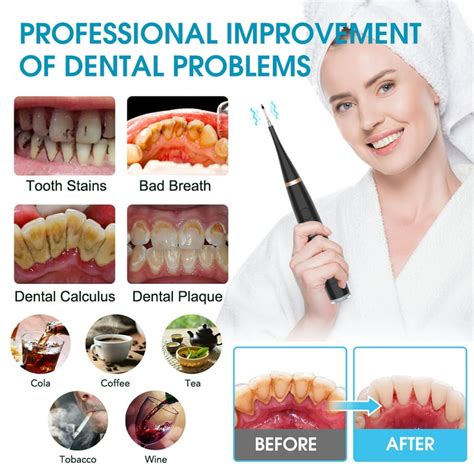 Dental Plaque Removal Tool - TheDentech.com