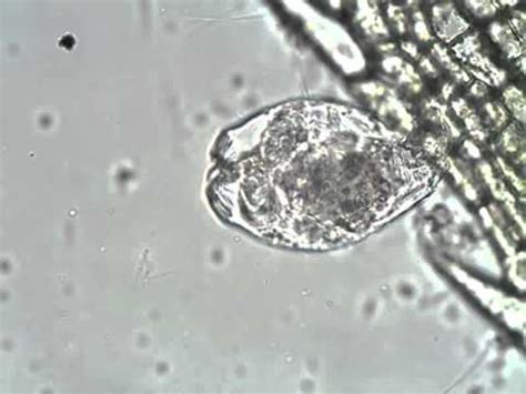 Protists Under Microscope