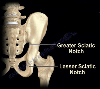 Structures That Pass Through the Greater Sciatic Notch ...