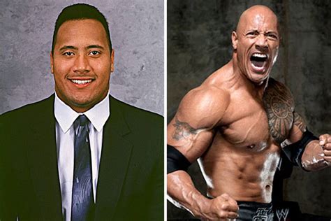 The Rock’s Before and After Plastic Surgery Photos are a Testament to ...