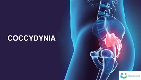 What is Coccydynia? | causes | Symptoms | treating tail bone pain?