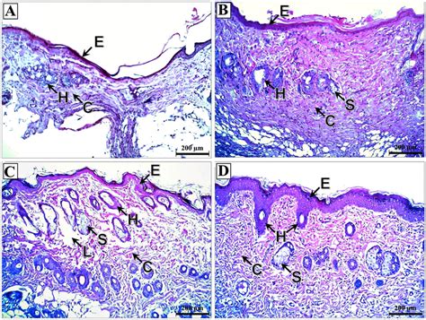 Photomicrographs of skin flap sections of the induced flap ischemia... | Download Scientific Diagram