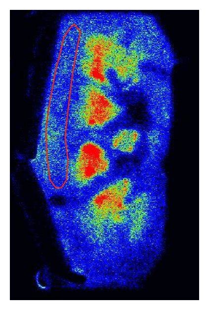 Examples of digital autoradiography (a) and a PET scan (b). Digital... | Download Scientific Diagram