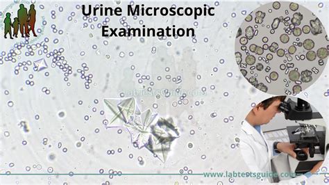 Urine Analysis:- Part Microscopic Examination And, 45% OFF