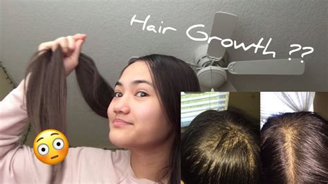 Before and After 30 Days Of Regrowth Challenge | Trichotillomania ...