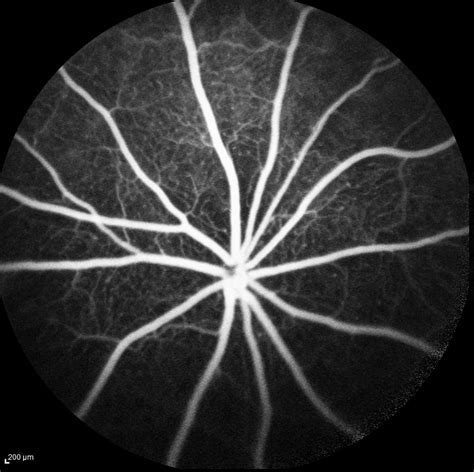 Scanning Laser Ophthalmoscopy (SLO) - ocutox