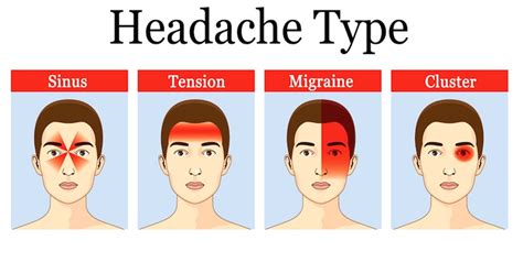 Headache : Types,Causes & Medication » How To Relief