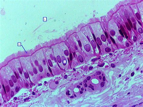 30 best Lung histology images on Pinterest