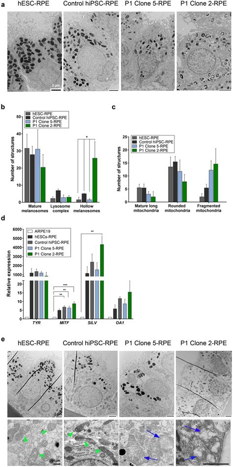 Ultrastructural examination of patient RPE cells. (a) Representative... | Download Scientific ...