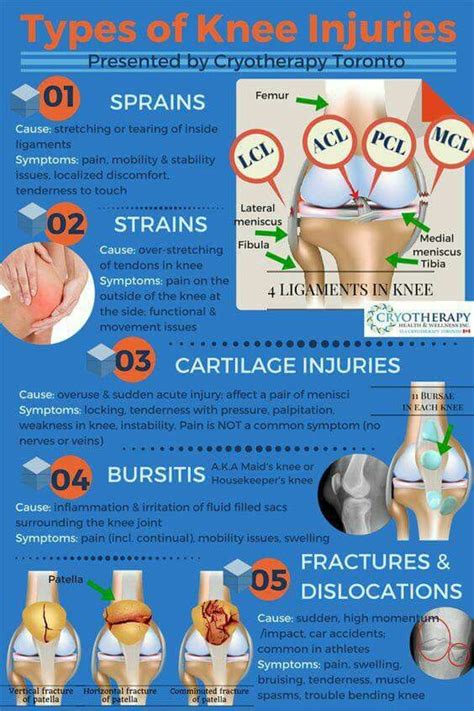 Knee Pain: Types of knee injuries