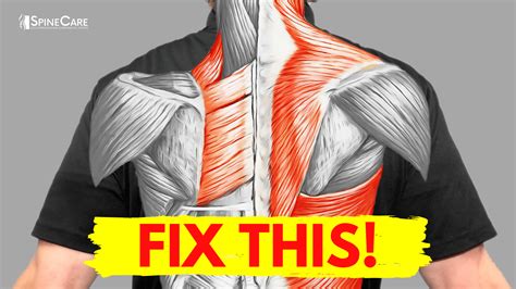 How to Fix Muscle Pain Between Your Shoulder Blades for Good | SpineCare