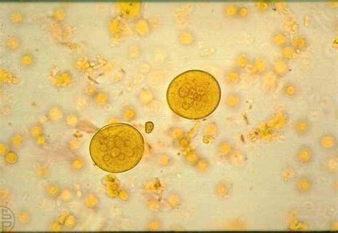 Entamoeba coli Cysts in feces | Medical Laboratories