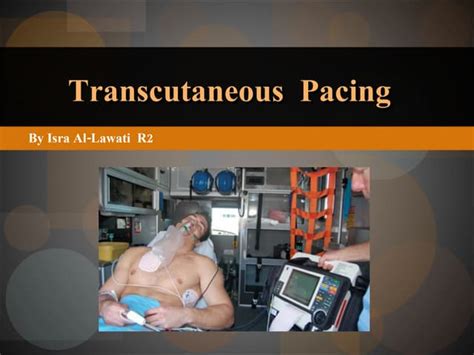 R2 Transcutaneous Pacing Procedure | PPT