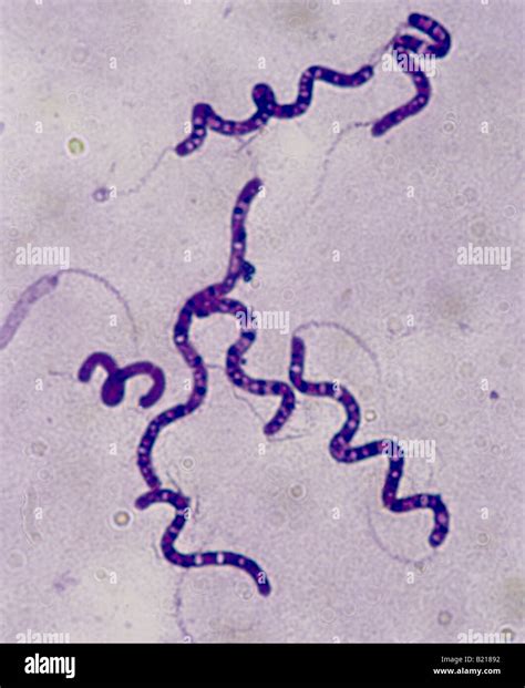 Spirilla Bacteria Under Microscope