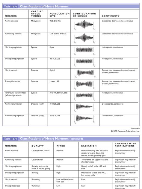 Classifications of Heart Murmurs | Cardiology | Medical Specialties