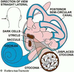 What is Benign Paroxysmal Positional Vertigo? - Vitamin Insider