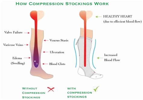 The 7 Benefits Of Running Compression Socks - Train For A 5K.com