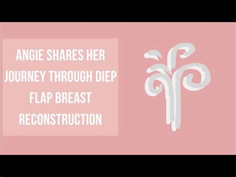 DIEP Flap Before and After Pictures - Houston Breast Re... | Doovi