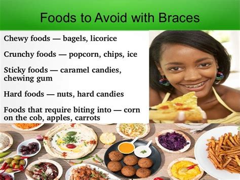 Foods to avoid with braces