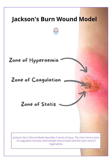 Phases Of Burn Healing