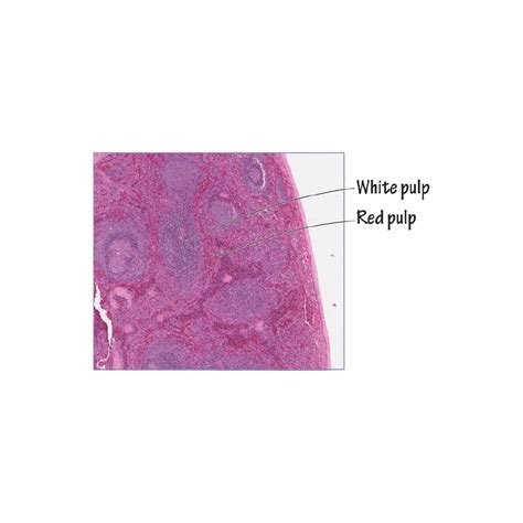 Histology Glossary: Spleen Anatomy & Histology | ditki medical & biological sciences