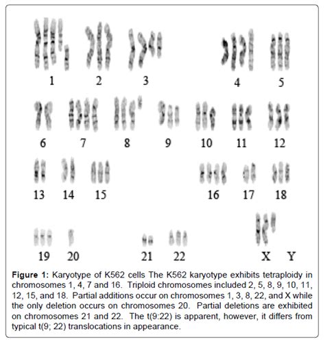 Apoptosis and Differentiation of K562 Cells by Targeting GST-O1 t