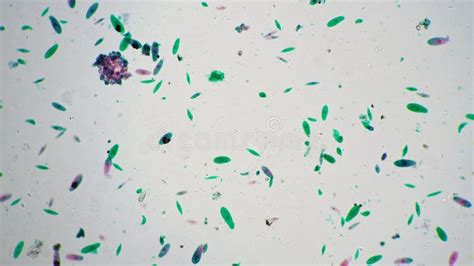 Euglena Under Microscope with 200 Times Magnification on Bright Field Background Stock Video ...