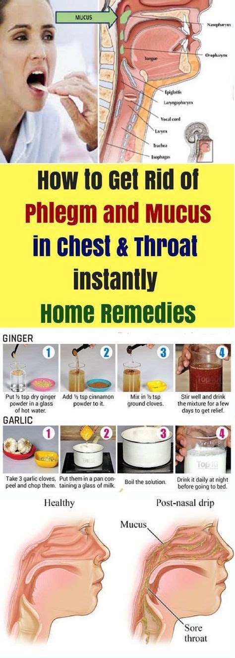 How To Get Rid Of Phlegm & Mucus In Chest & Throat Instantly. Home Remedies | Getting rid of ...