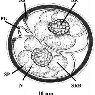 Isospora belli ooscysts in stool smear preparations. A: Iodine staining ...