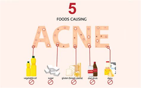 Acne Diet: 9 Foods That Cause Pimples(Plus Foods That Clear Them ...