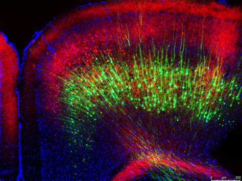 Neural Circuits | Behavior | Pluta Lab | Purdue University