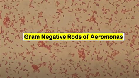 Gram Negative Rods |Aeromonas sobria |Gram Staining |Mag.4000X - YouTube