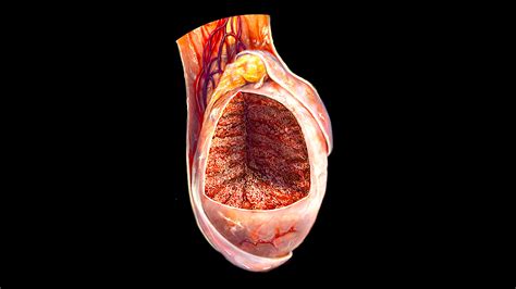 Epididymitis - StoryMD