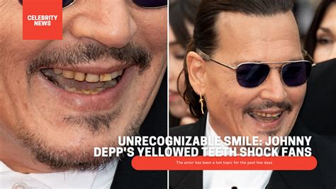 Unrecognizable Smile: Johnny Depp's Yellowed Teeth Shock Fans