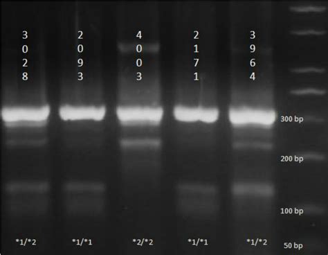 a. Example image of gel electrophoresis results. | Download Scientific Diagram