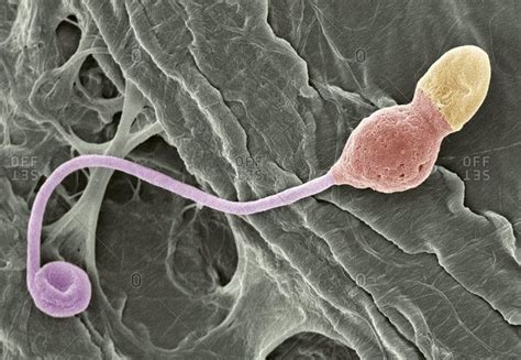 Magnification view of a deformed sperm cell under a Color scanning ...