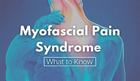 Understanding Myofascial Pain Syndrome: Causes, Symptoms, and Diagnosis